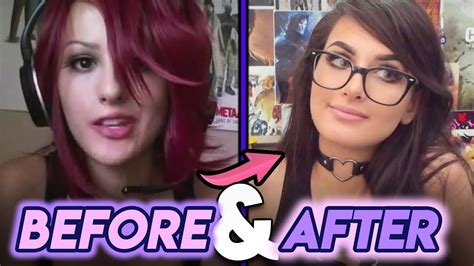 Sssniperwolf Before and After Plastic Surgery Rumours